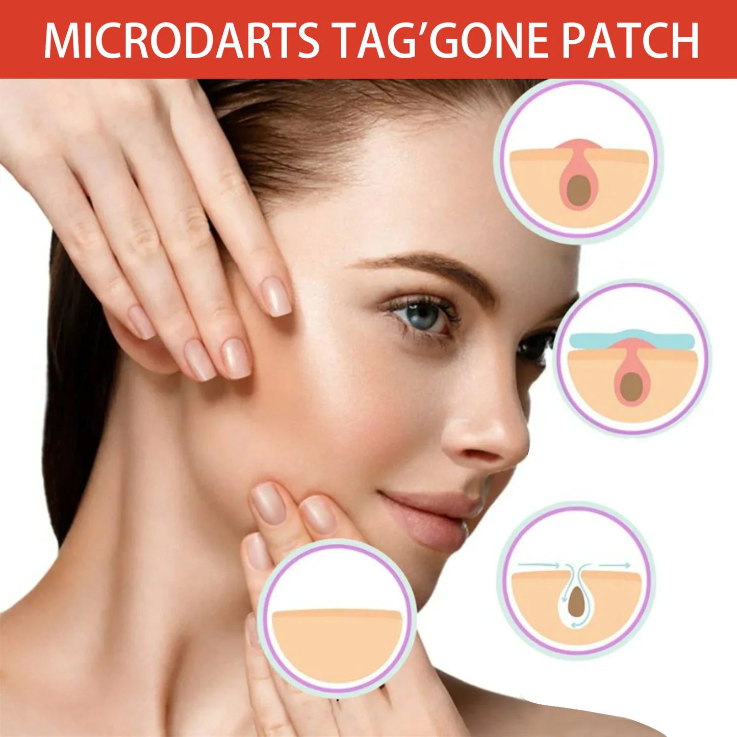 Anti-Acne & Mole Repair Skin Patch