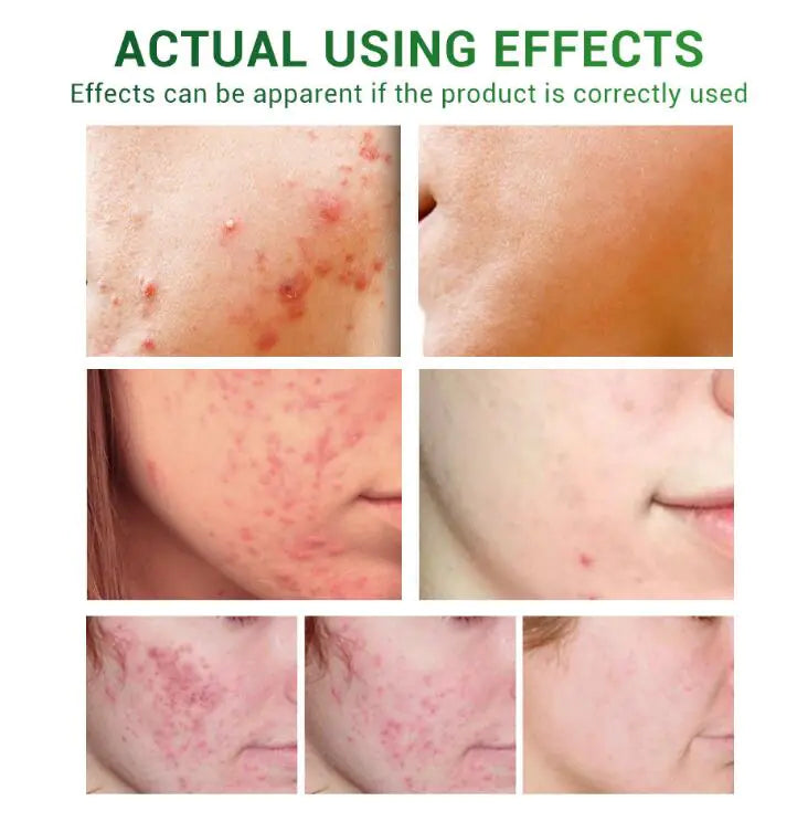 Essential Oils for Scar Repair and Skin Care