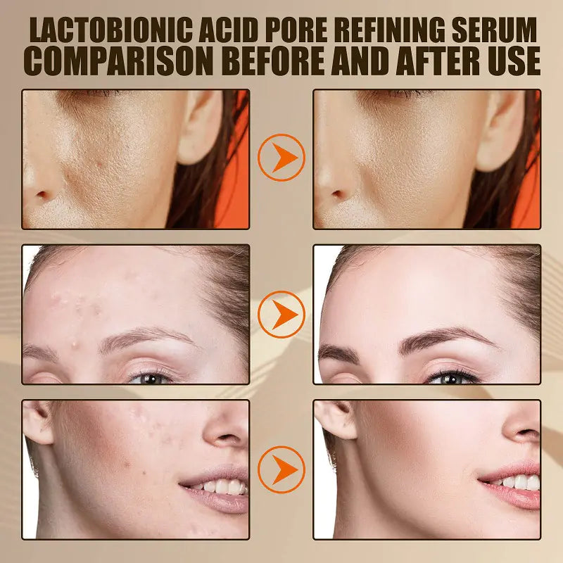 Lactobionic Acid Pore Minimizing Serum for Skin Care