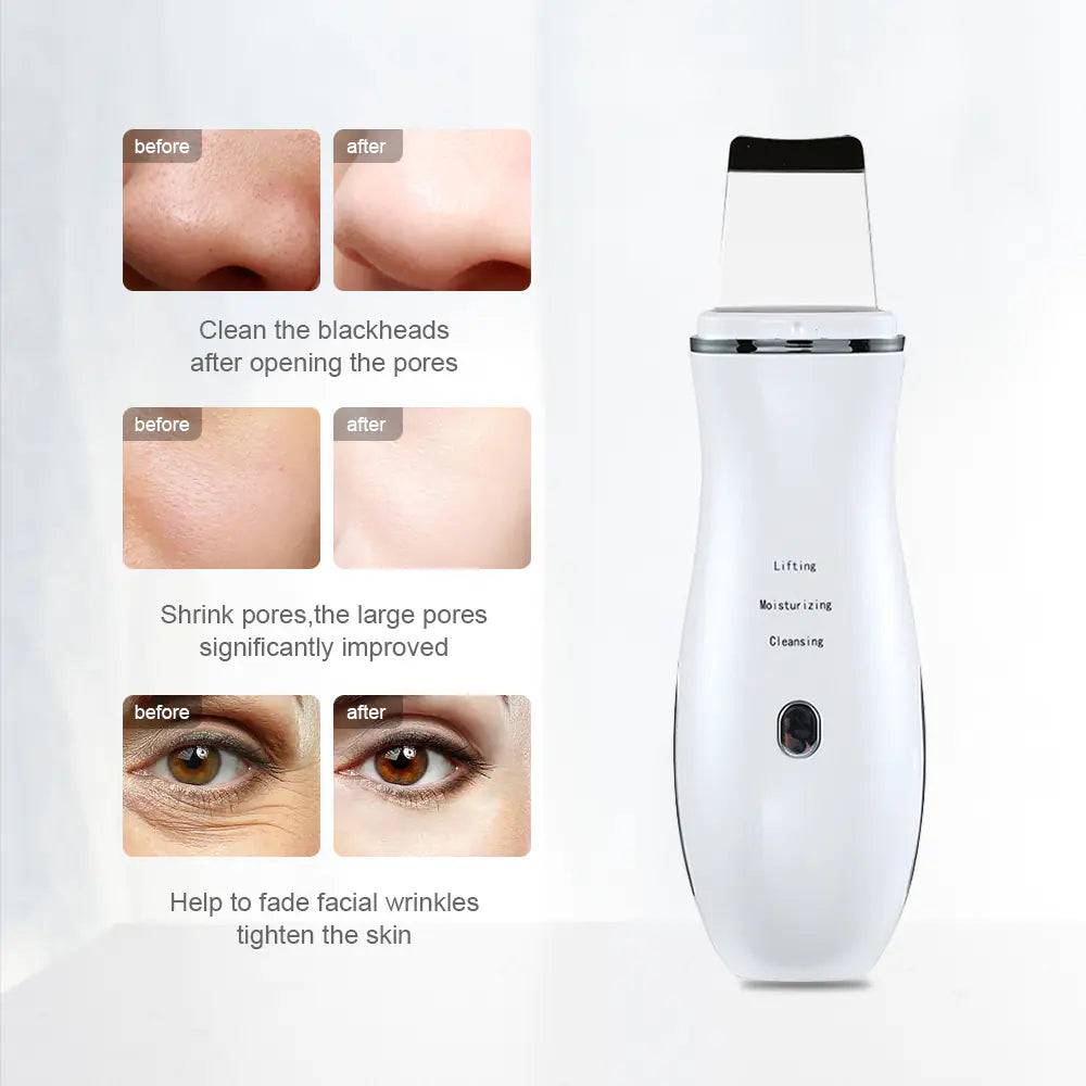 Ultrasound Skin Scrubber Facial Cleansing Device